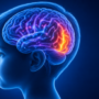 Approccio alla diagnosi e alla terapia delle lesioni cerebrali occipitali nei bambini